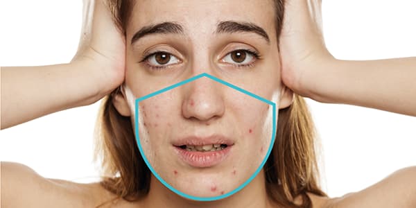 HOW TO ROCK THE YEAR OF THE MASK - MIE Skincare