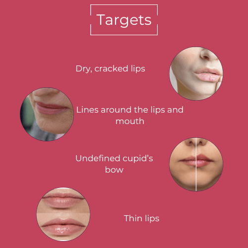 3D Lip Plumping Treatment - MIE Skincare