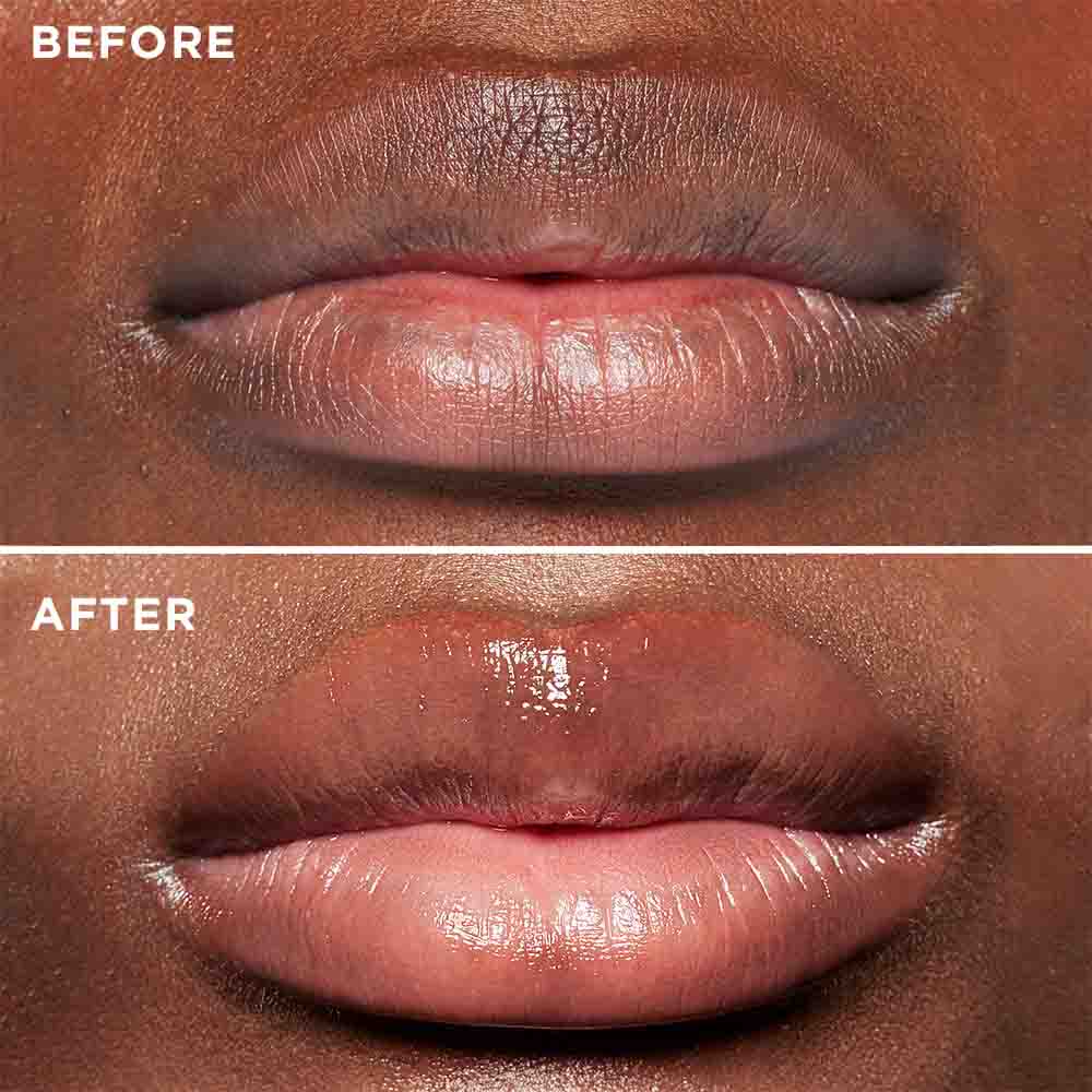 3D Lip Plumping Treatment - MIE Skincare