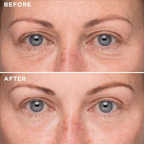 Triple Complex Eye Lift Serum -US - MIE Skincare