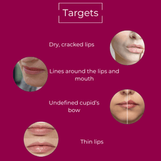 Hydrating Lip Plumper - MIE Skincare