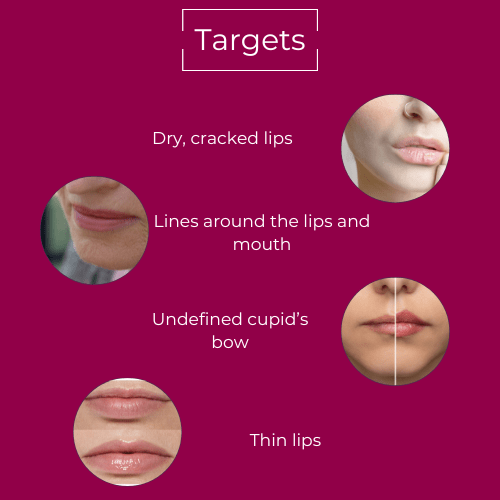 Hydrating Lip Plumper - MIE Skincare