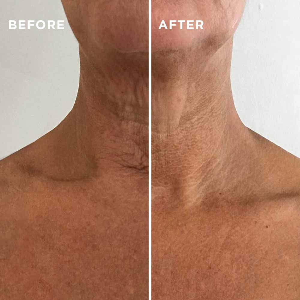 Rejuvenating Neck and Chest Serum - AU - MIE Skincare