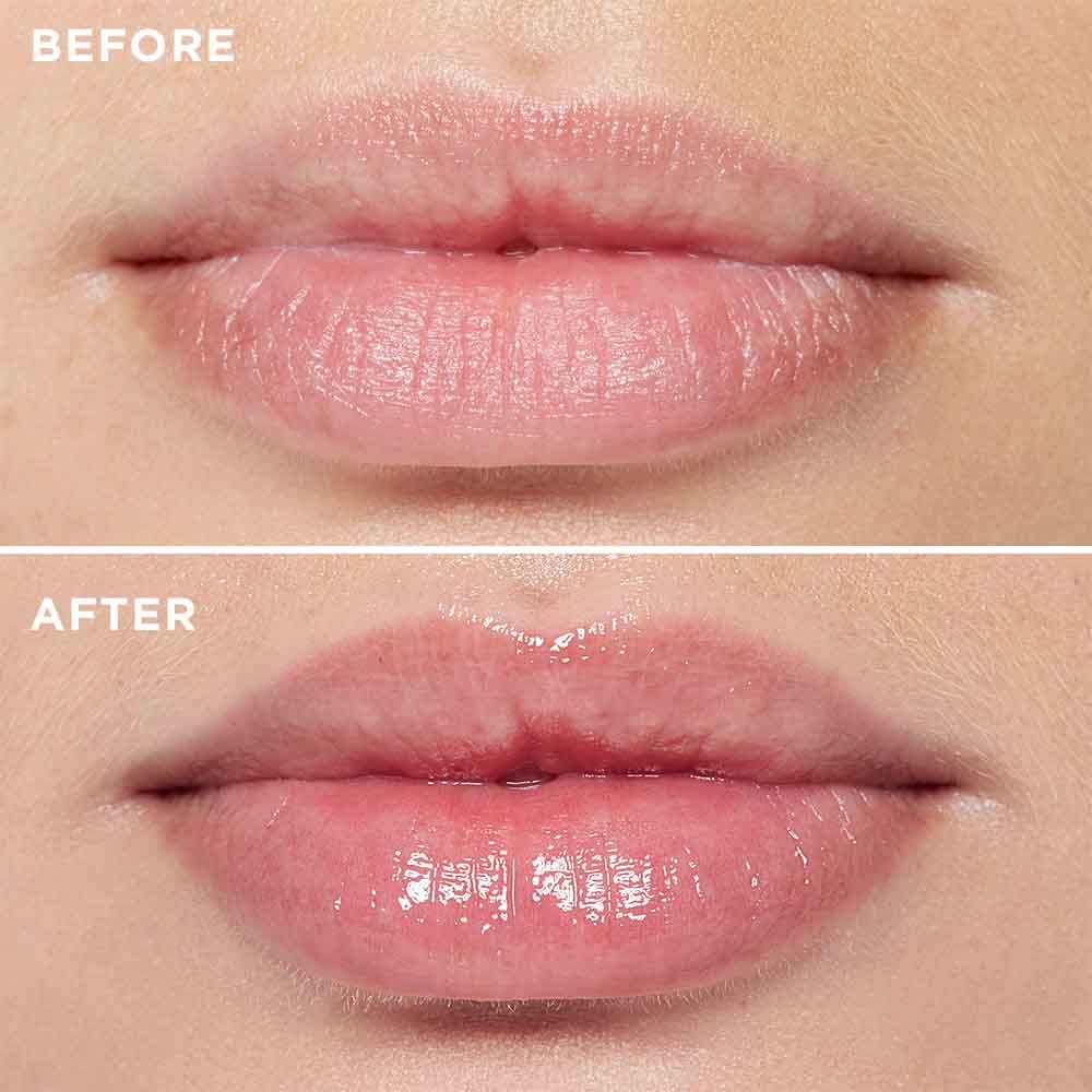 3D Lip Plumping Treatment -US - MIE Skincare