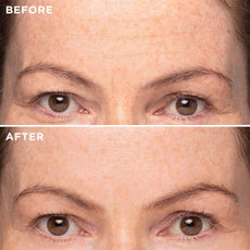 Deep Line Elixir - MIE Skincare