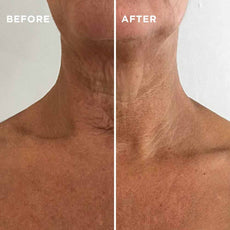 Neck & Chest Rejuvenating Serum -US - MIE Skincare