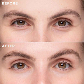 Triple Complex Eye Lift Serum -US - MIE Skincare