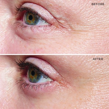 Before and after using De-Puffing Eye Serum