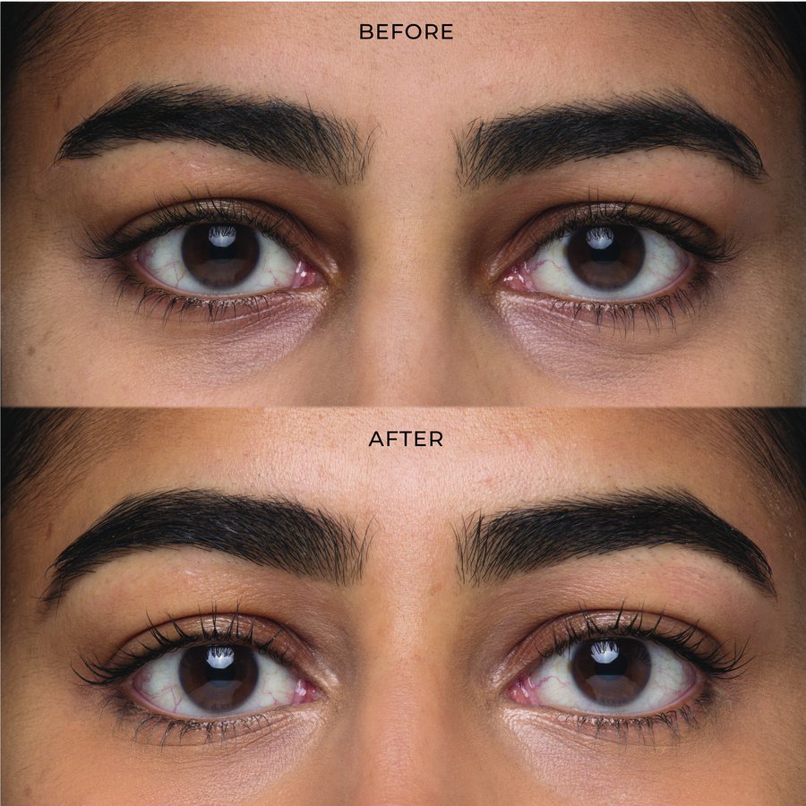 Real results on real skin. Every claim independently lab-tested.