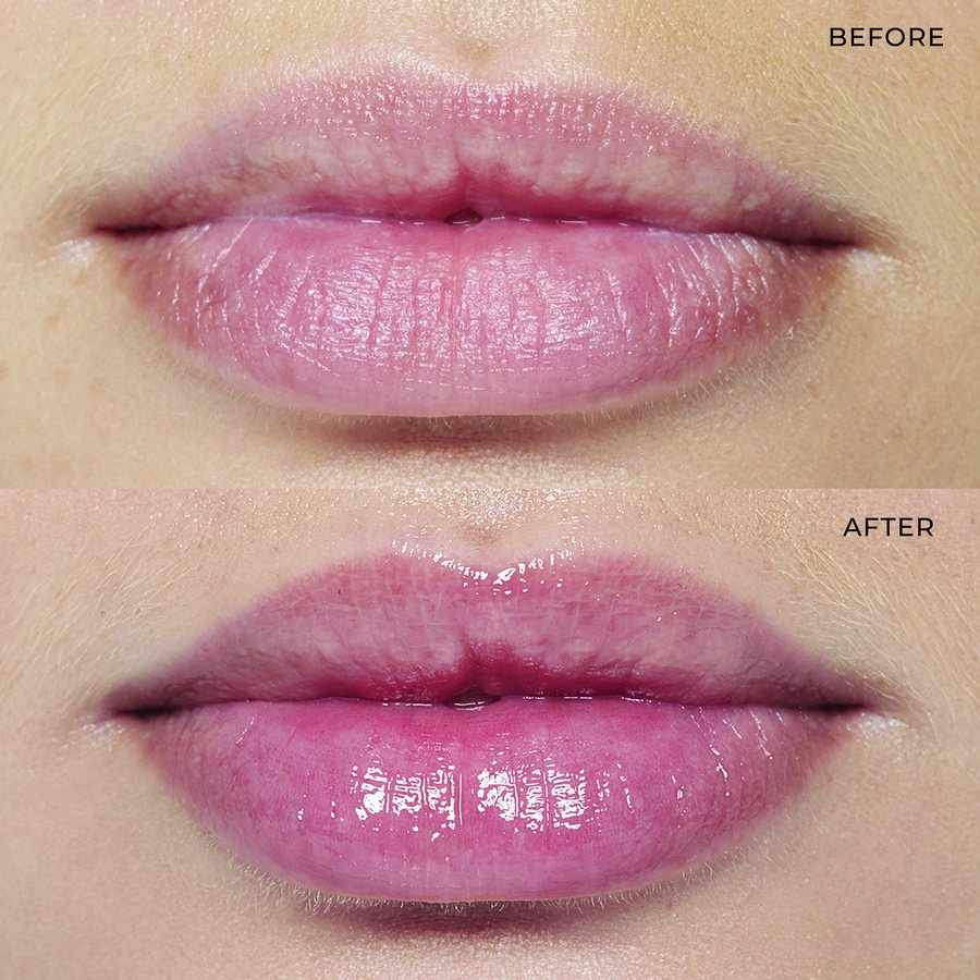Hydrating Lip Plumper: 20% plumper lips in two minutes. No sting.